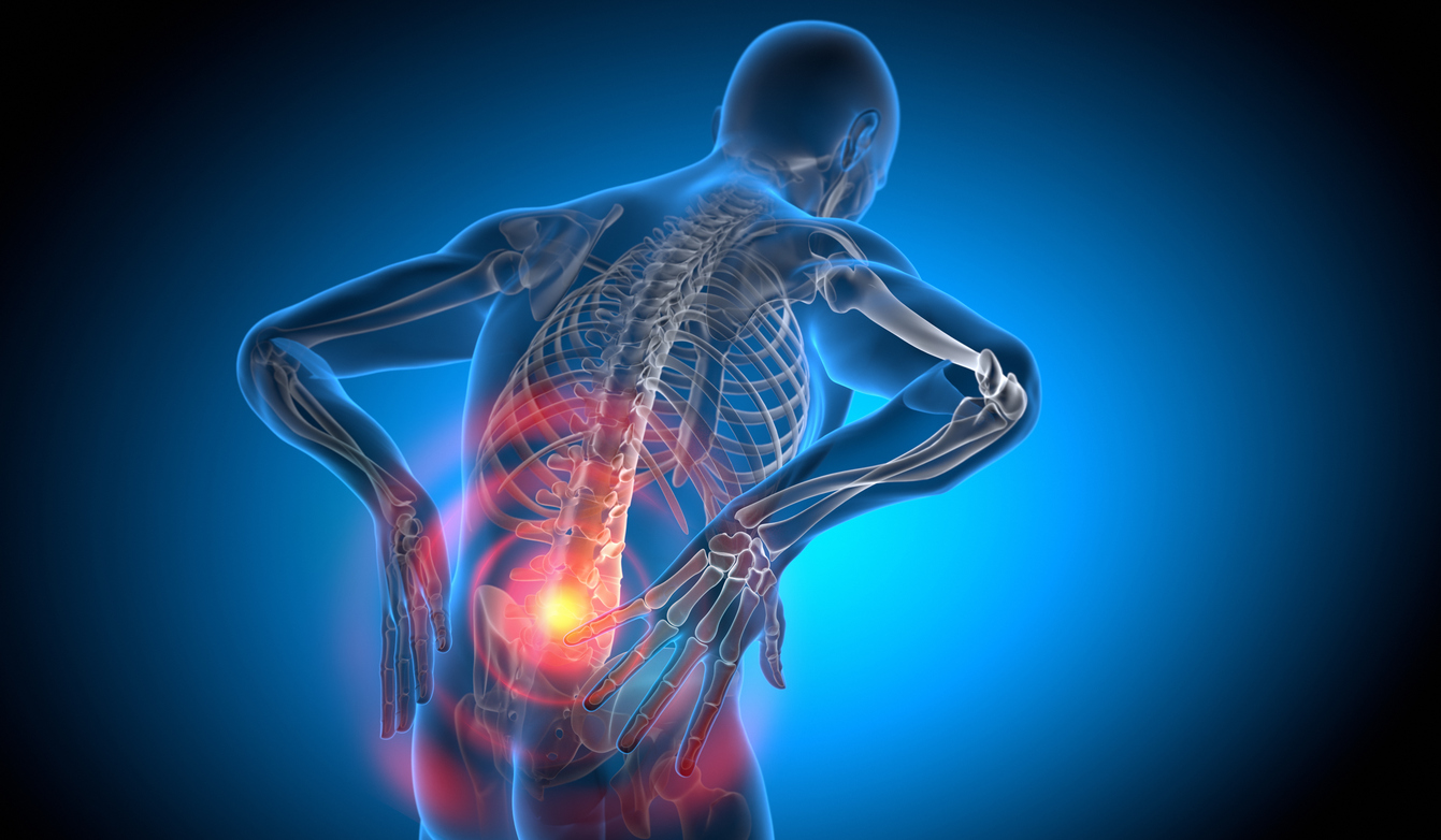 Spondylolysis