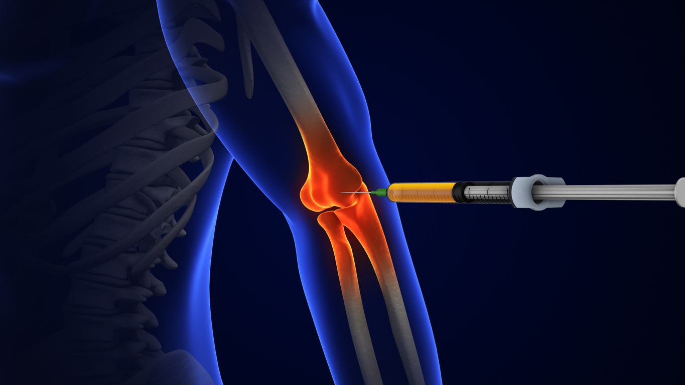 Peripheral Joint Injections